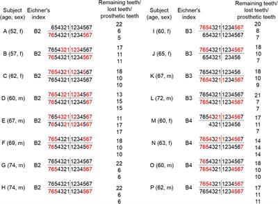 Prefrontal Consolidation and Compensation as a Function of Wearing Denture in Partially Edentulous Elderly Patients